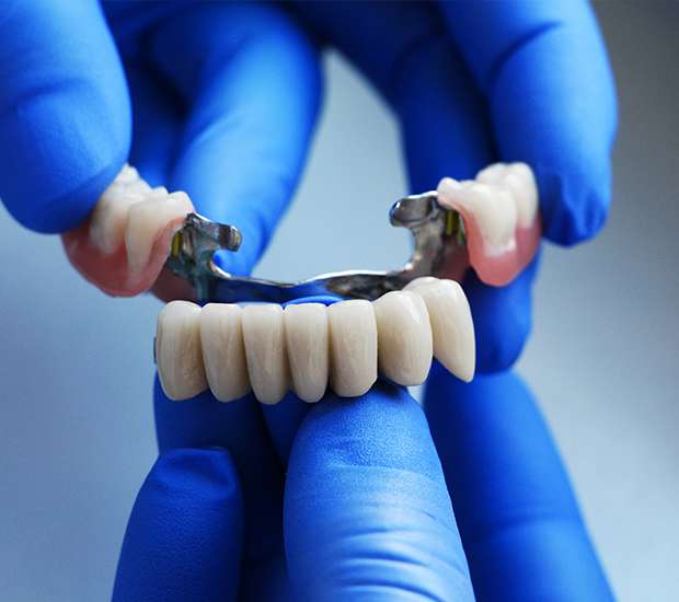 Placentia Dental Bridges