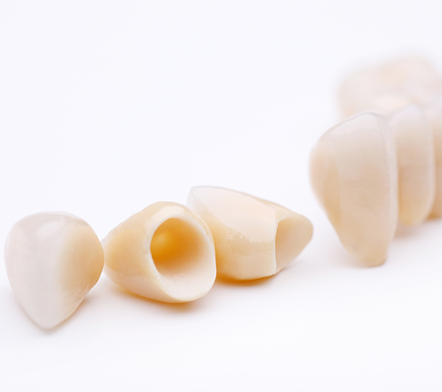 Placentia Dental Crowns and Dental Bridges