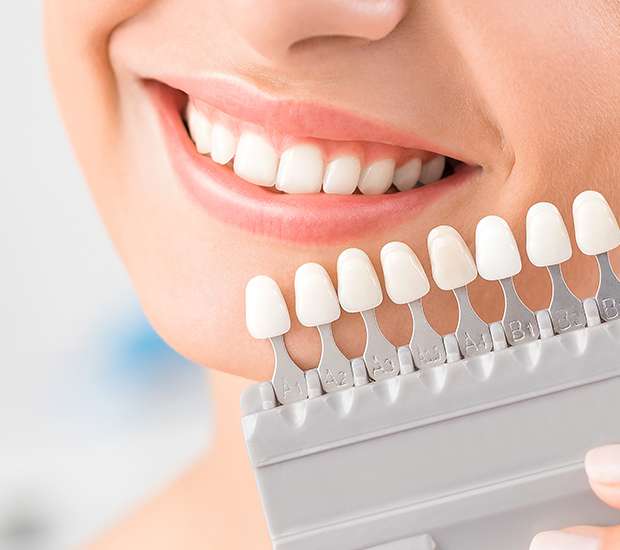 Placentia Dental Veneers and Dental Laminates