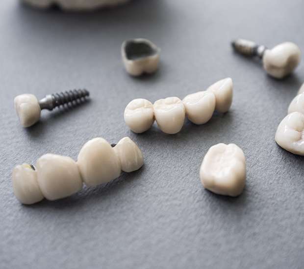 Placentia The Difference Between Dental Implants and Mini Dental Implants